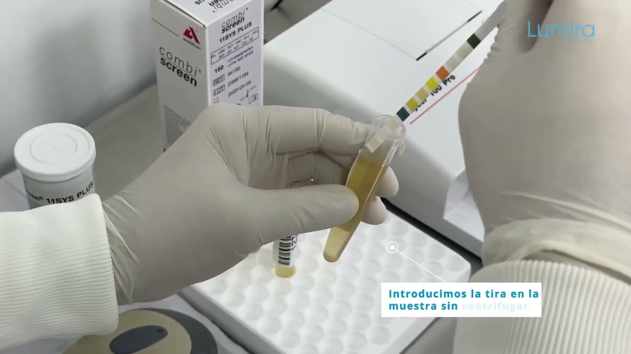 🔬 Montaje de Pruebas en el Urilyzer 100 Pro Analyticon - Lumira | Guía Paso a Paso