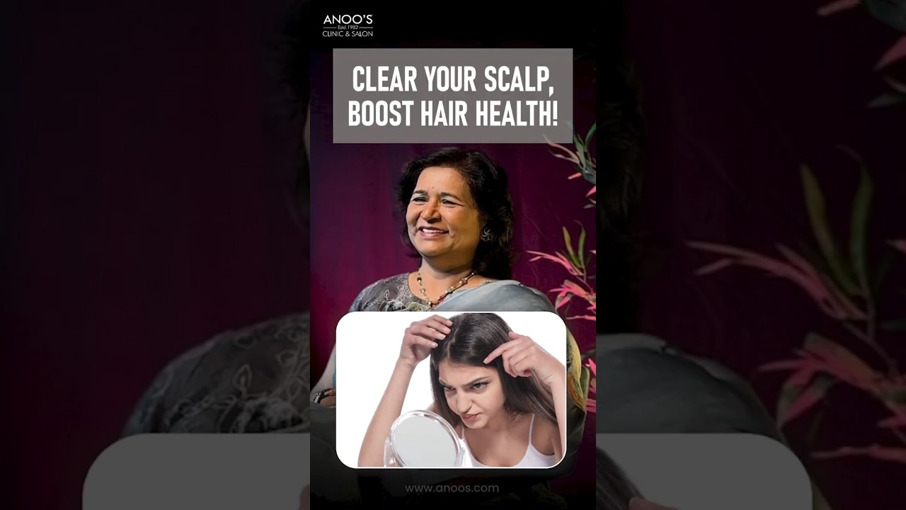Oily Scalp, Greasy Roots & Dandruff? Fix the Real Cause  