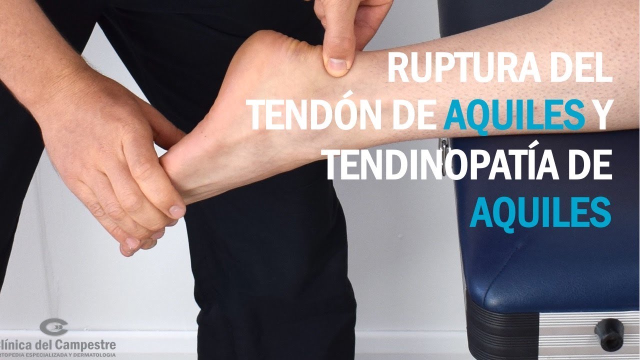 Ruptura del tendón de Aquiles y Tendinopatía de Aquiles