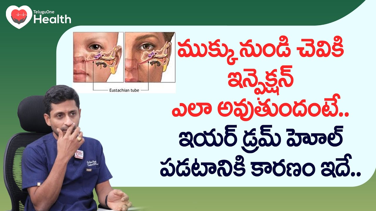 Eardrum Hole | ఇయర్ డ్రమ్ హోల్ పడటానికి కారణం ఇదే.. Dr. Moganti Ashok Prudviraju | TeluguOne Health