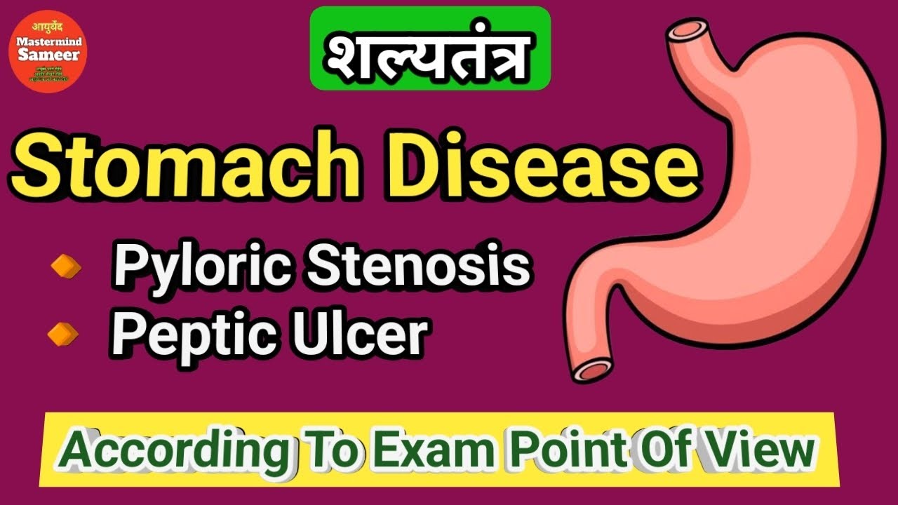 Disease Of Stomach And Duodenum In Hindi | Peptic Ulcer | Pyloric Stenosis | Shalya Tantra | BAMS |
