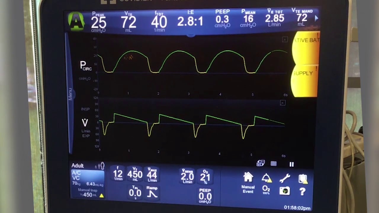 Post-intubation care (MedStar Emergency Physicians)