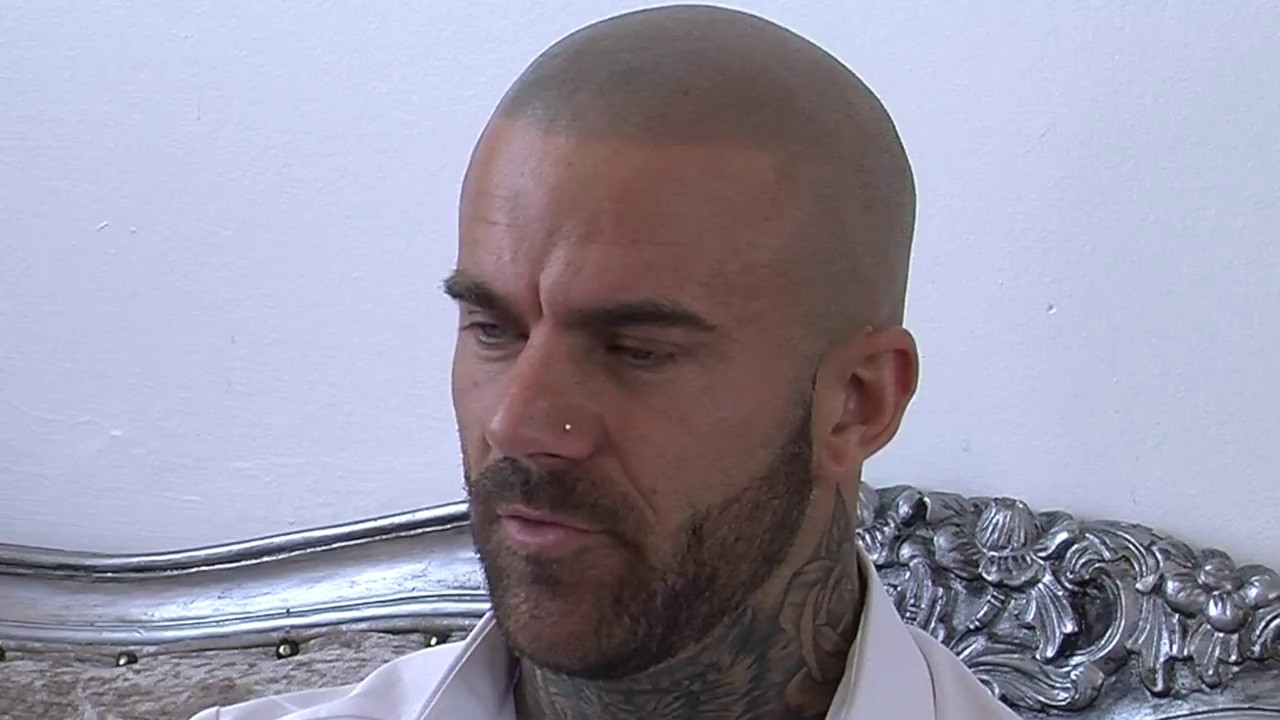 Scalp Micropigmentation Skalptec UK | Skalptec SMP Video Testimonial | Ashley Morris Fitness Model