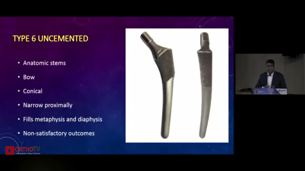Dr Anoop C Dhamangaonkar - Uncemented Femoral Stems
