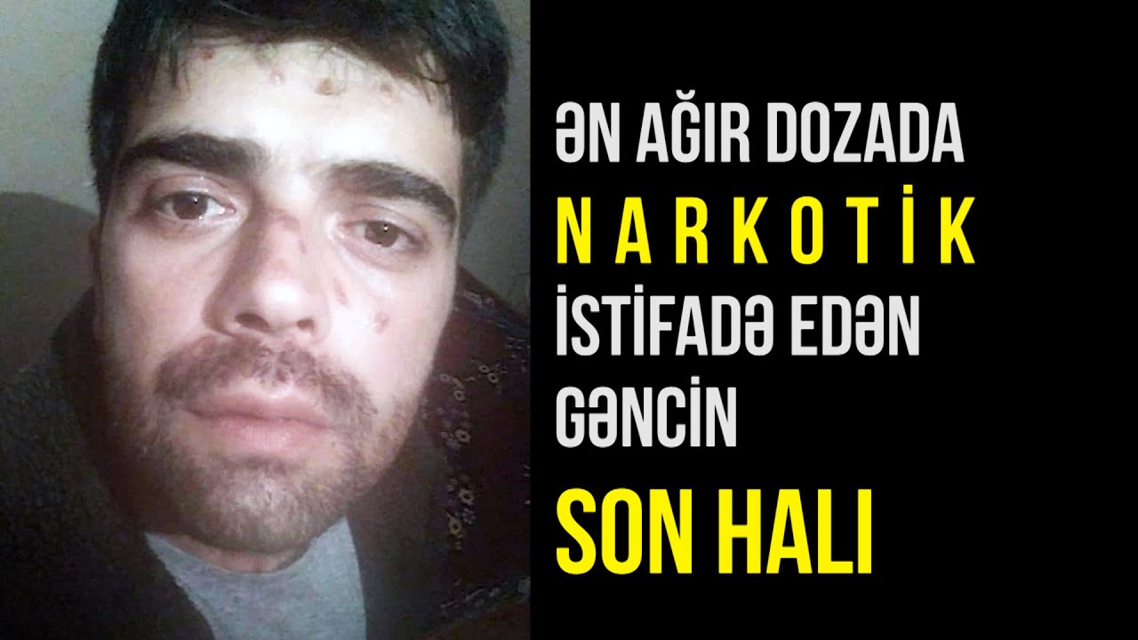 İNANILMAZ REALLIQ / Gənc narkoman NARKOTİKDƏN canını görün necə qurtarıb / Elvinin başına gələnlər