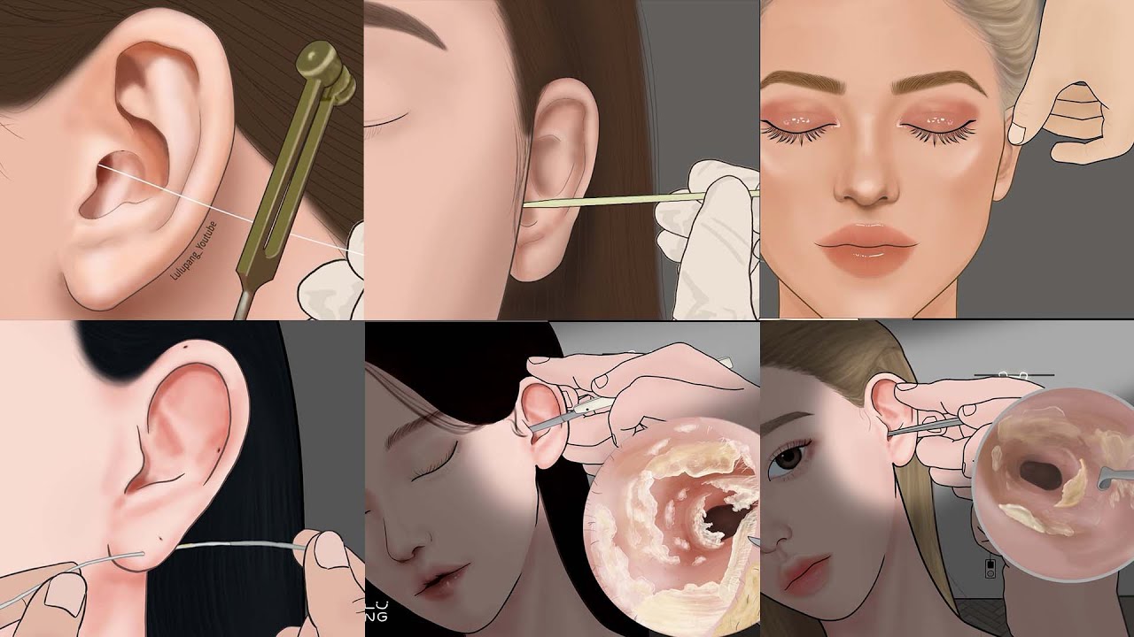 시각적 팅글 폭발하는 귀청소 ASMR 애니메이션 모음집! 귀내시경, 귀파기