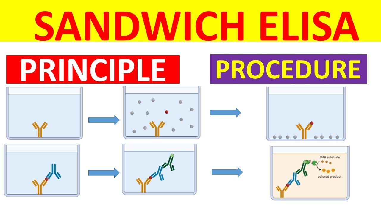 Sandwich ELISA | Sandwich ELISA Procedure | Sandwich ELISA Principle | Sandwich ELISA Assay |