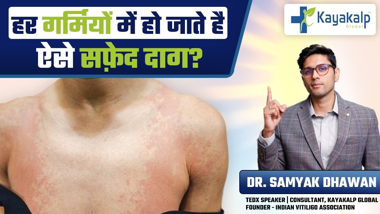 हर गर्मियों में हो जाते है सफ़ेद दाग? | Tinea Versicolor Treatment | Kayakalp Global