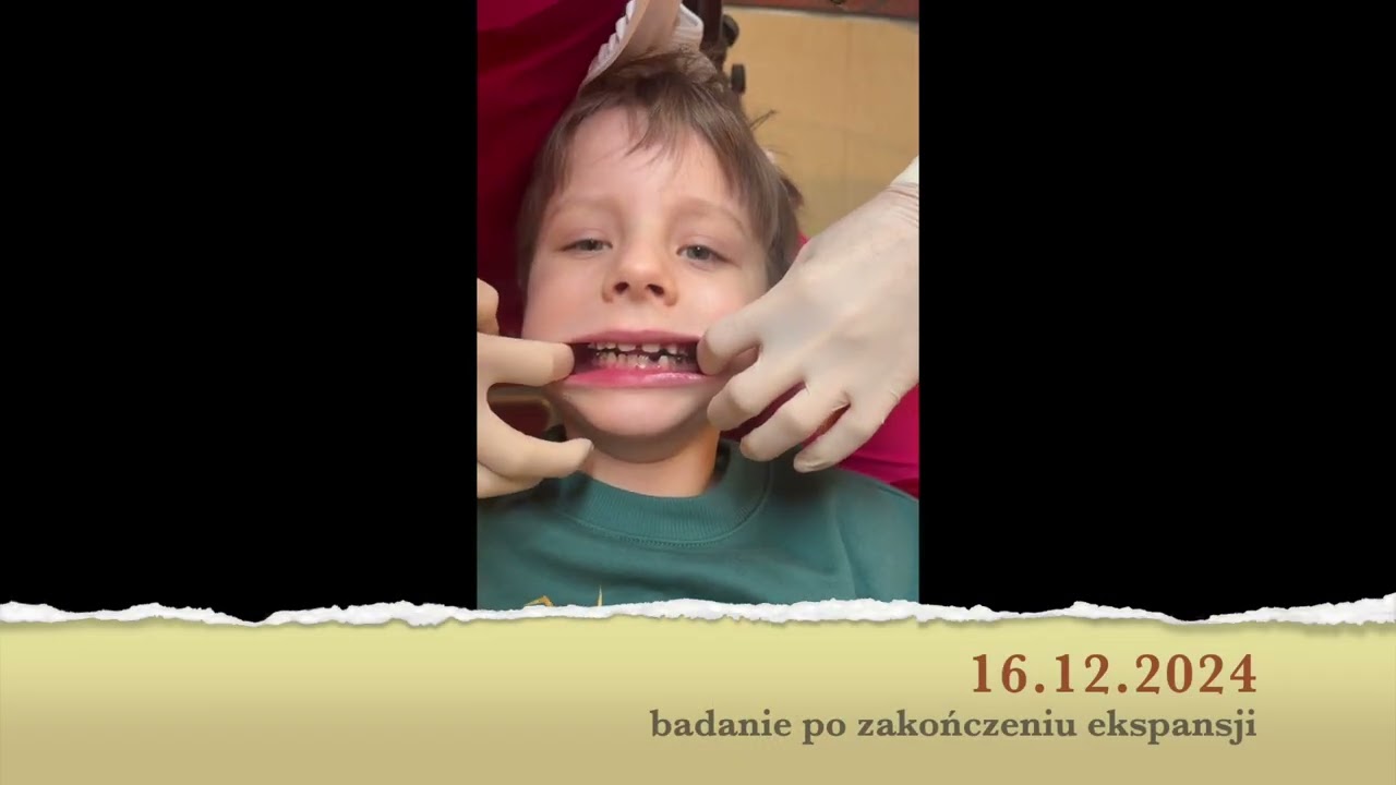DENTIFLO.fot.12.54