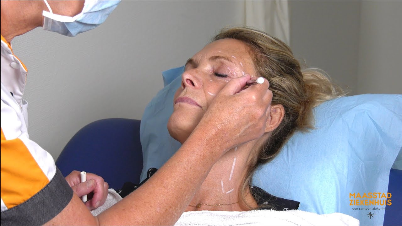 Ooglidmassage na een ooglidcorrectie