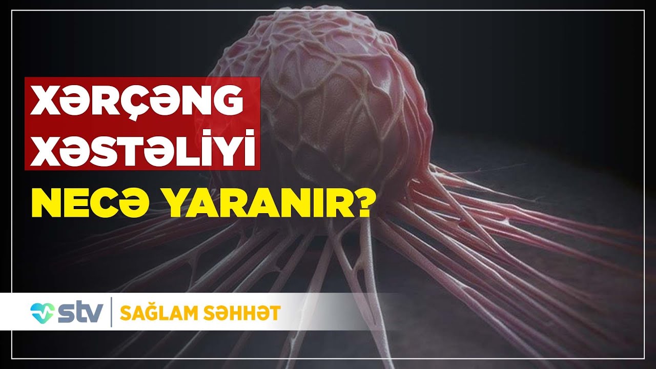 XƏRÇƏNG XƏSTƏLİYİ NECƏ YARANIR?