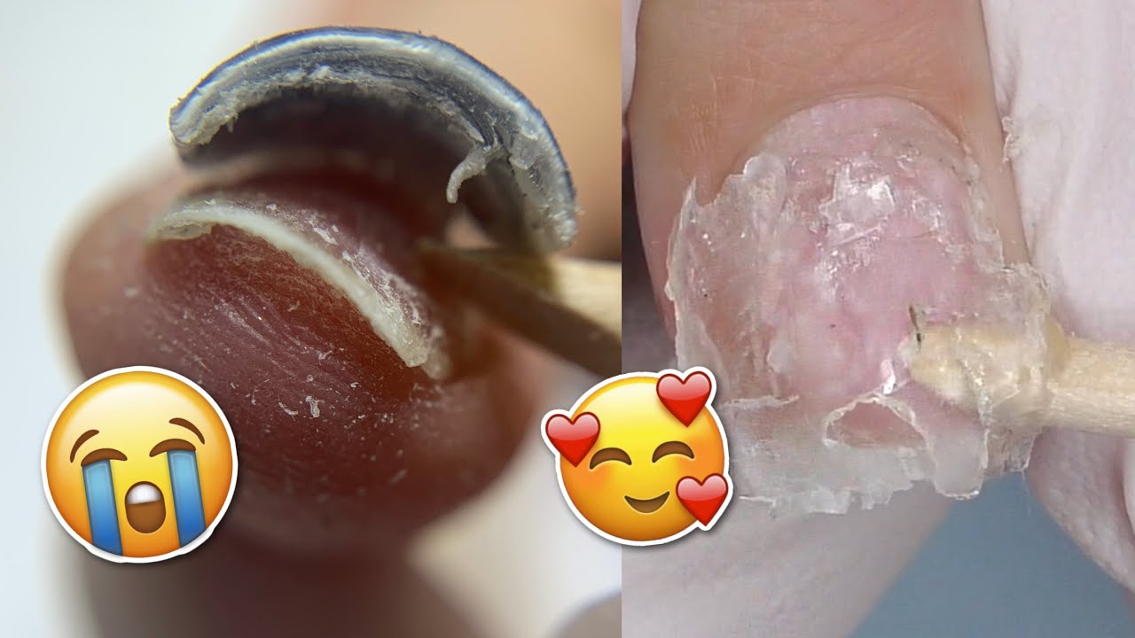 Damage FREE Soft Gel Nail Extensions Removal