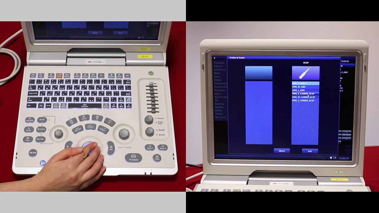 Mindray Z6: How to enter patient details and select pre-sets on the Z6 - video 1