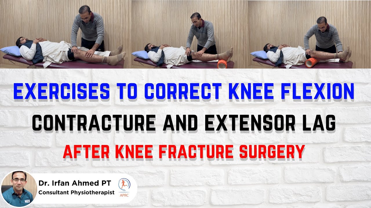 Top Exercises to Fix Limp, Flexion Contracture & Weak Quads After Knee Surgery | Urdu | Hindi