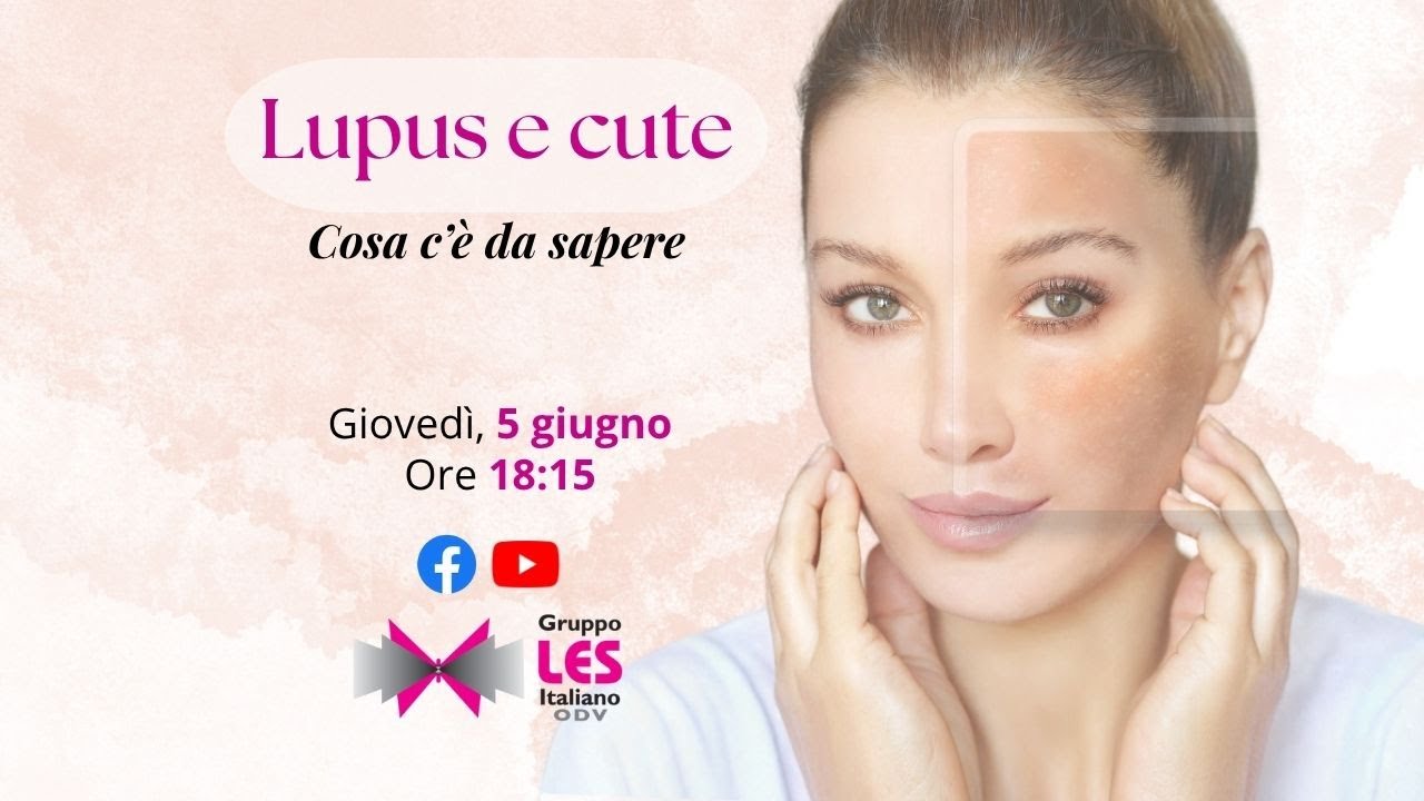 LUPUS E CUTE