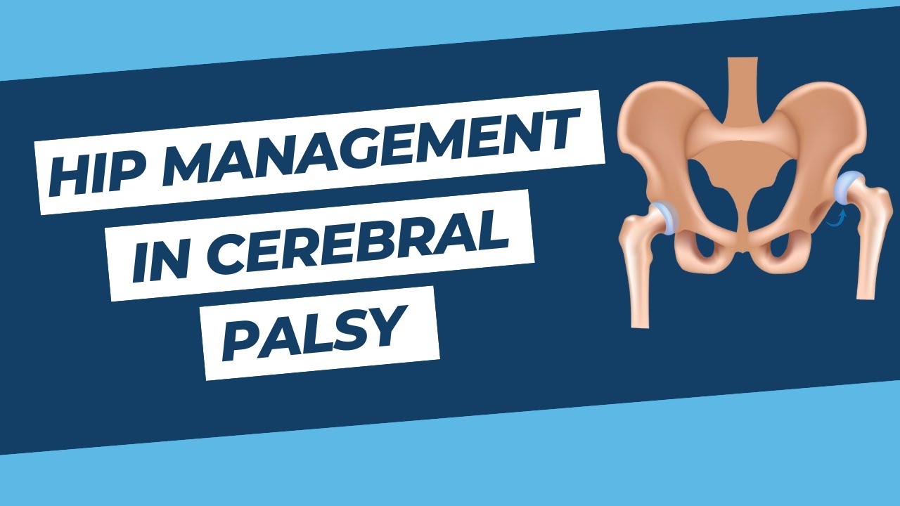 Hip Management in Cerebral Palsy | Gross Motor Function Classification System (GMFCS)