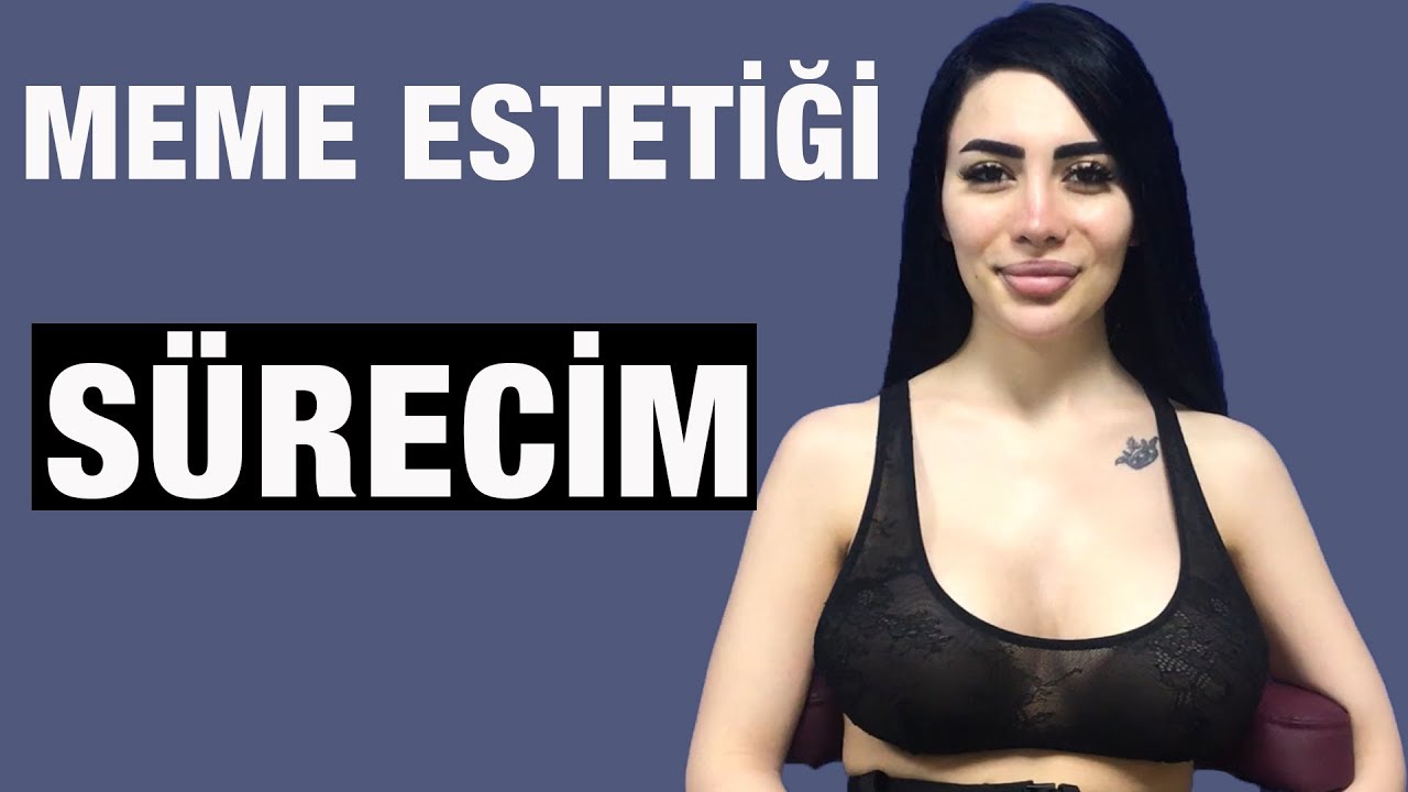Göğüs Estetiği Sürecim | Dr. Fatih DAĞEDELEN