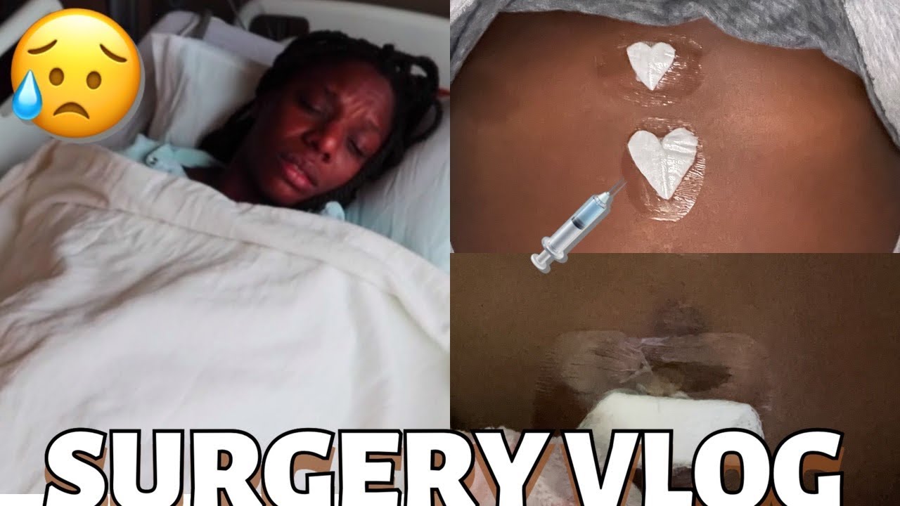VLOG: RECOVERING FROM GALLBLADDER SURGERY!
