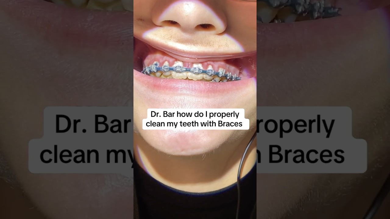 Are you cleaning your teeth with Braces Correctly? Here's the Right way! 👍