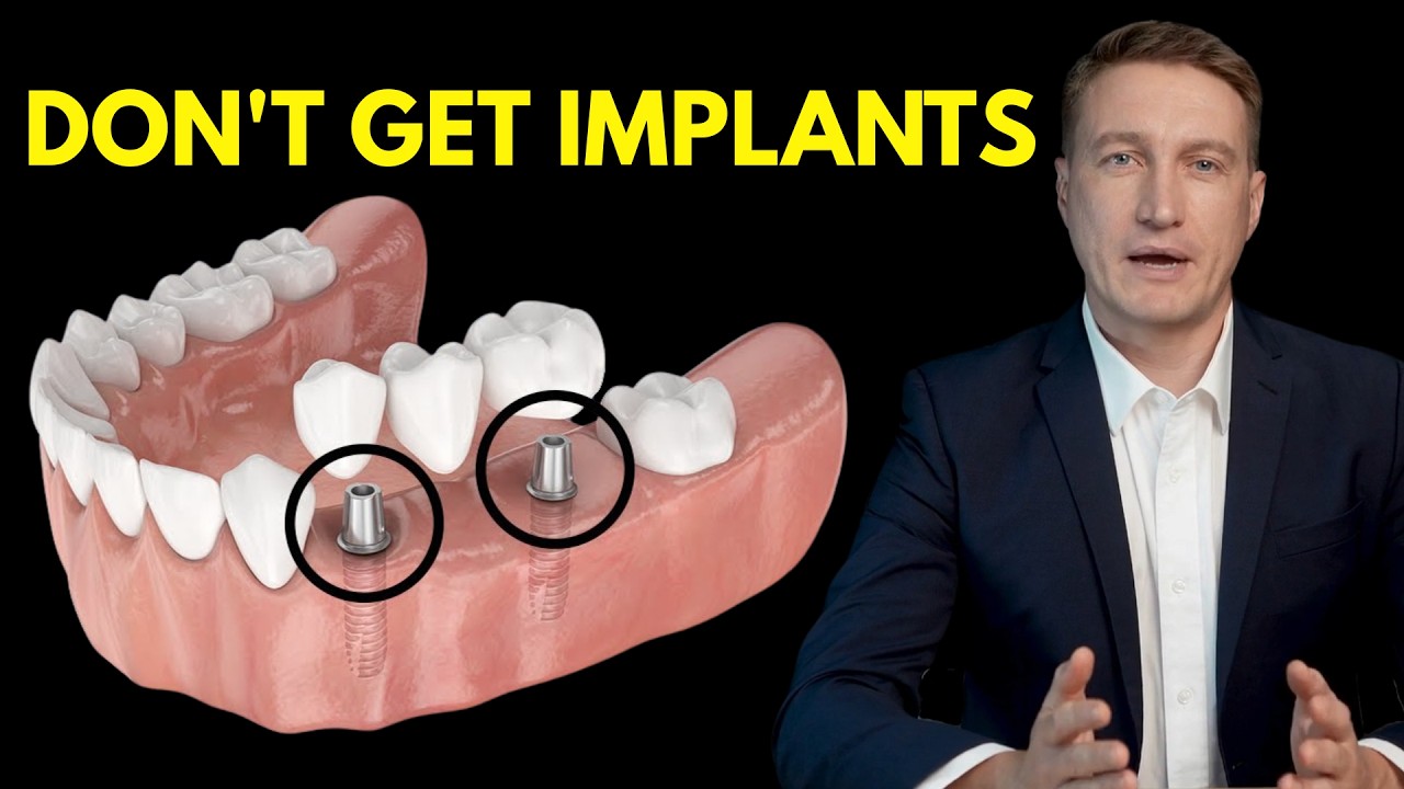 Don't get implants until you know this! Dentists aren't telling you the truth.