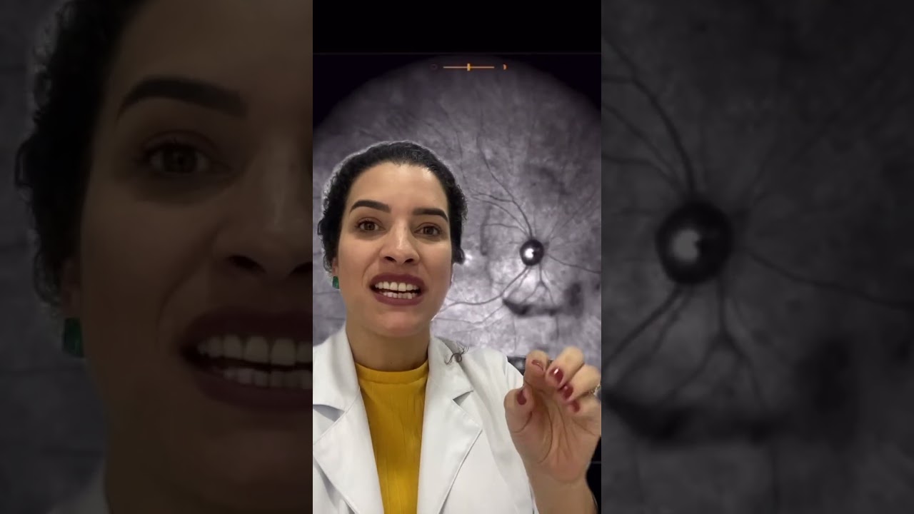 Entendendo as moscas volantes