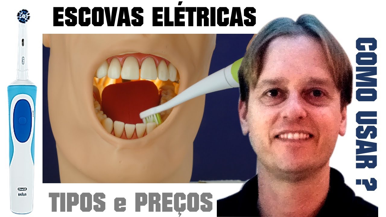 Escovas de Dente Elétricas São Boas? Tipos, Preços e Como Usar