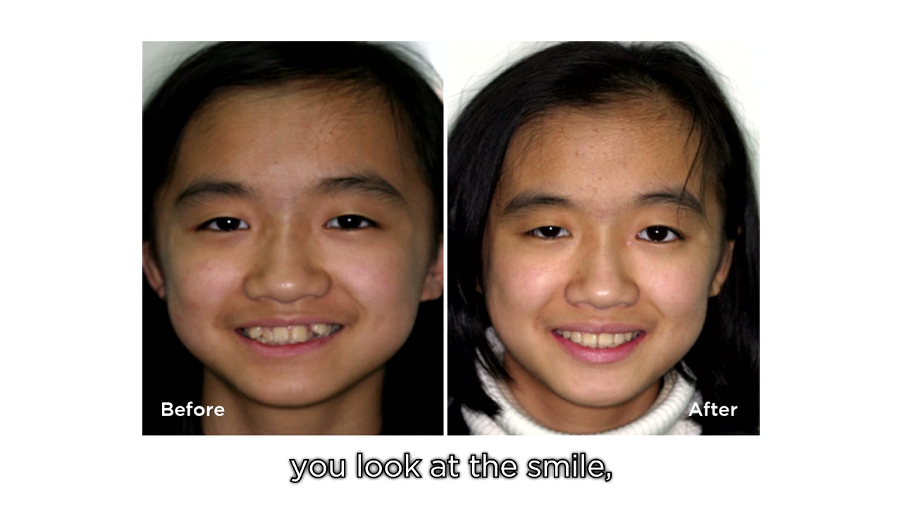 Smile Bright With Us: 