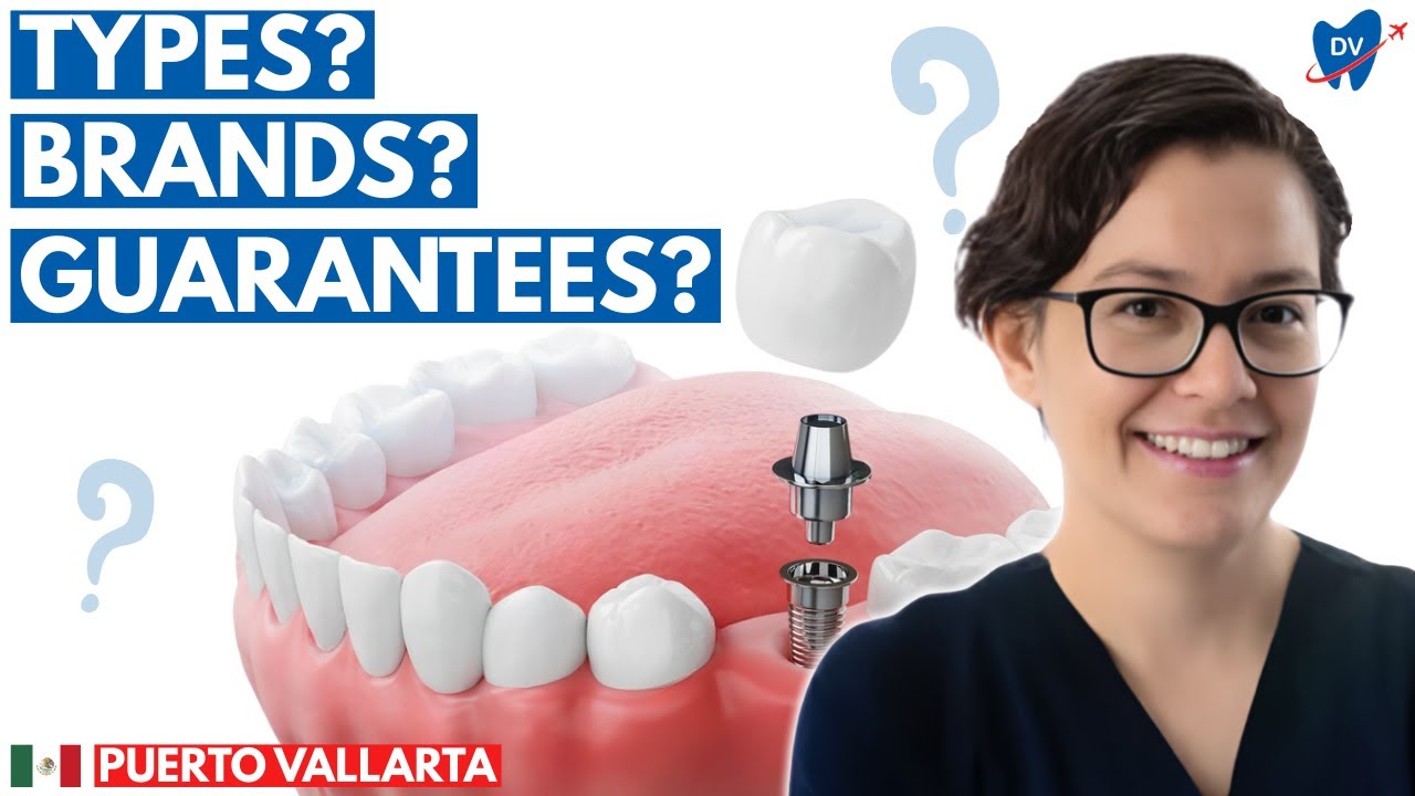 Dental Implants in Puerto Vallarta, Mexico: 4 Questions You MUST Ask Before Surgery
