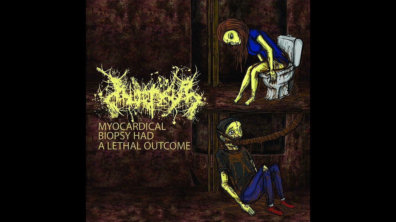 Inopexia - Myocardical Biopsy Had A Lethal Outcome (Full Album)