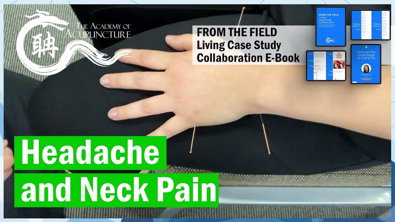 Headache, Neck Pain, LBP - Acupuncture 1,2,3! #eileenhan #theacademyofacupuncture #譚針#韓玉齡 #懷聃天應穴平衡針法