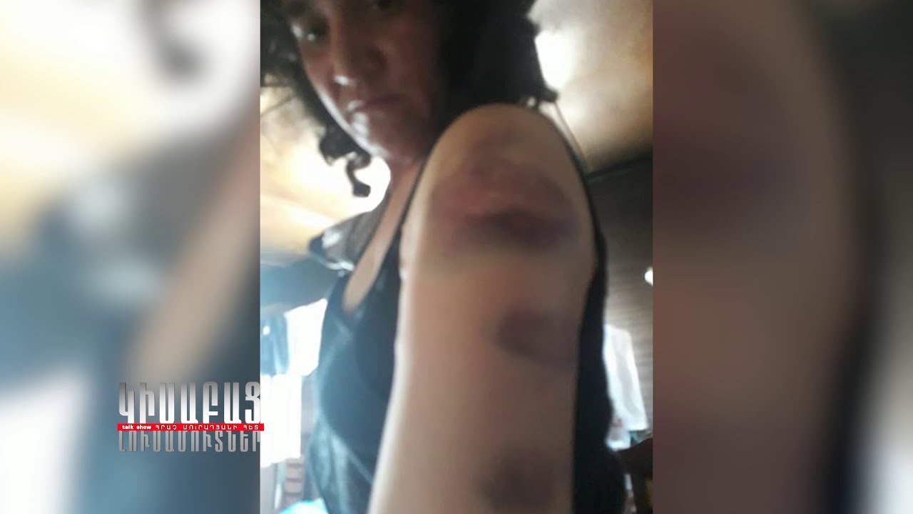 Hoviv Kine 2 / Kisabac Lusamutner 08.01.19