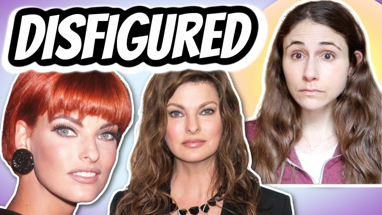 Linda Evangelista BRUTALLY DISFIGURED from COOLSCULPTING | Dermatologist Responds | Dr Dray