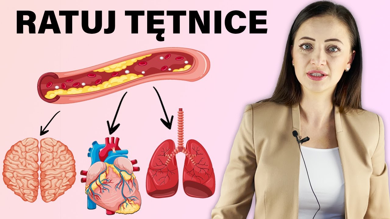 Wysoka homocysteina: Szkodnik drażniący tętnice! Jak obniżyć homocysteinę? | dr Angelika Kargulewicz