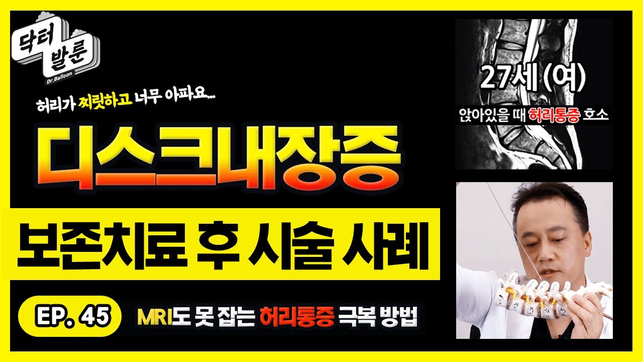 【치료사례】 극심한 허리통증으로 고생하셨던 27세(여) 환자분의 디스크내장증 실제 치료사례 ㅣ닥발TV
