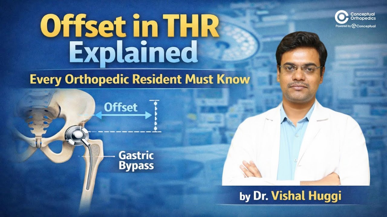 Offset in THR Explained | Every Orthopedic Resident Must Know | Dr. Vishal Huggi