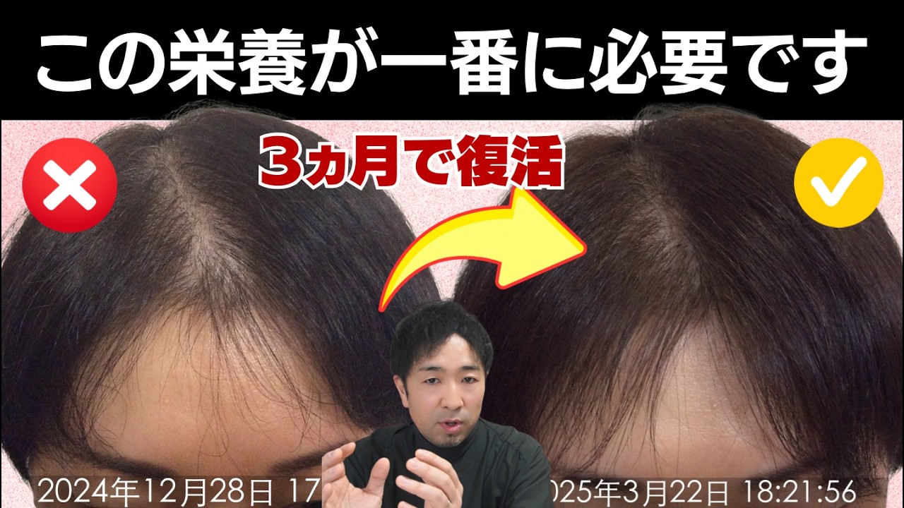 【最新研究】髪を太くする”炭水化物”由来のエネルギー足りていますか⁉｜3ヶ月で発毛した方法