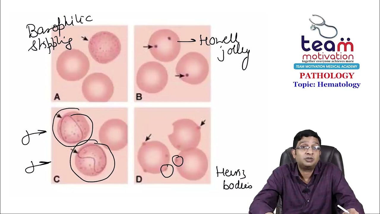 Normal & Abnormal RBCs by Dr. Ashutosh Aggarwal Sir |  Hemat @TeamMotivationFMGENEXTAcademy