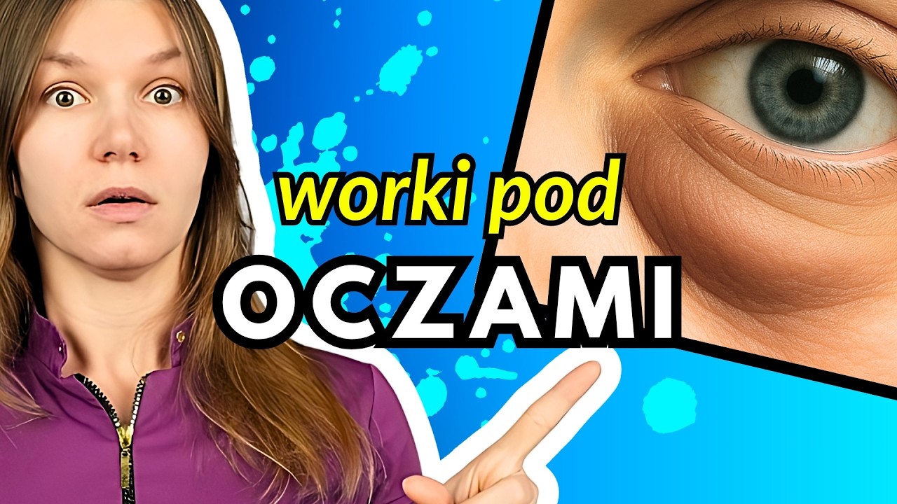 ⚠️ Worki Pod Oczami? Zrób To ZANIM Kupisz Krem!
