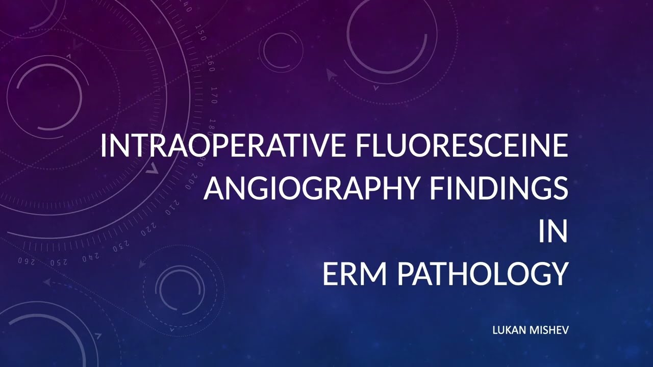 Saudi Retina Symposium 2026 IOFA findings in ERM pathology Lukan Mishev