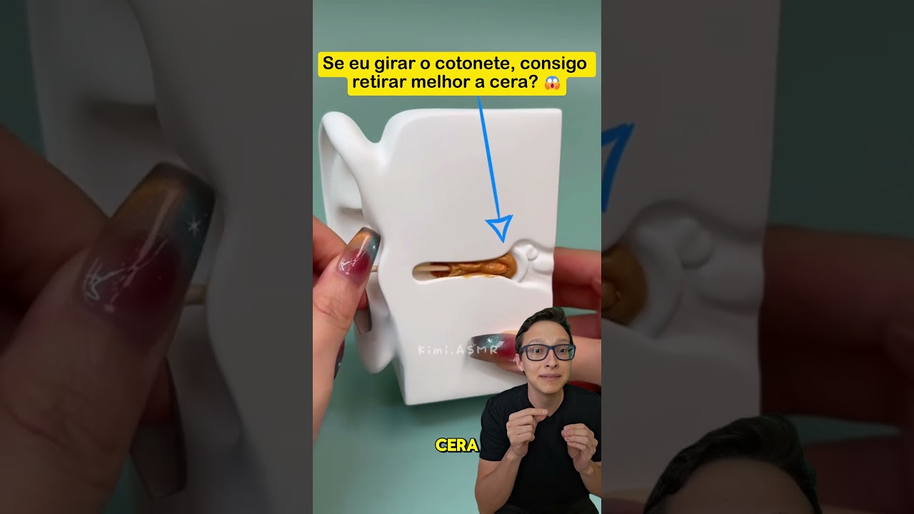 Cotonete no ouvido 😱👂 #medicina #medico #ouvido #enfermagem #limpezadeouvido #saude #audicao #orelha