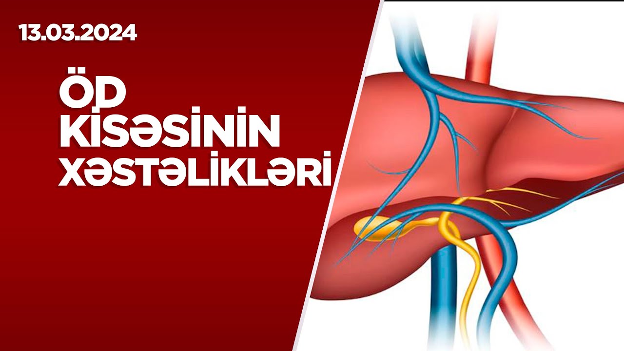 Can sağlığı: Öd kisəsinin xəstəlikləri