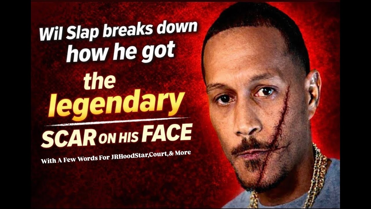 Wil Slap Explaining How He Got The Scar On His Face/Choice Words For Court JrDa HoodStar And Others