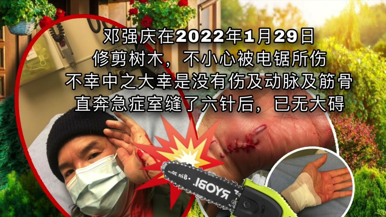 邓强庆受伤