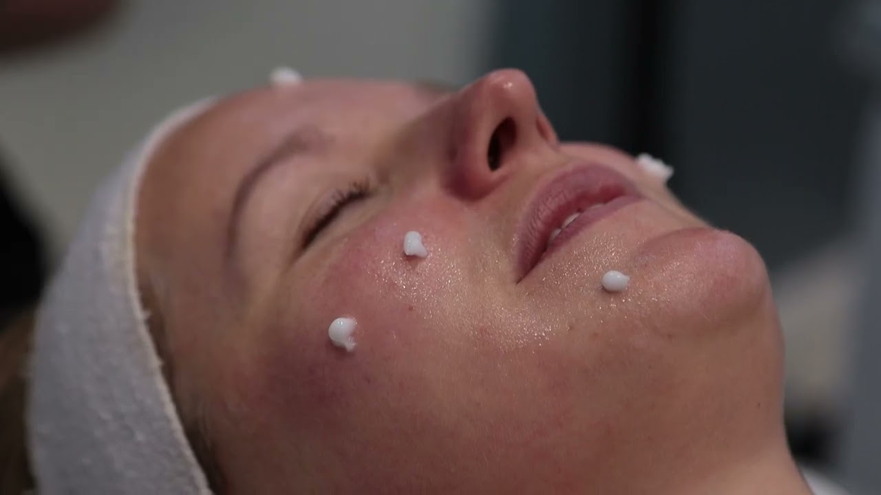 Experience the best facial available on the market 3D Hydrofacial