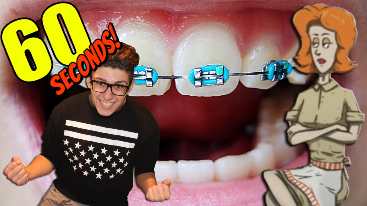 60 SECONDS ITA - TOLTO IL DENTE TOLTO IL DOLORES!!