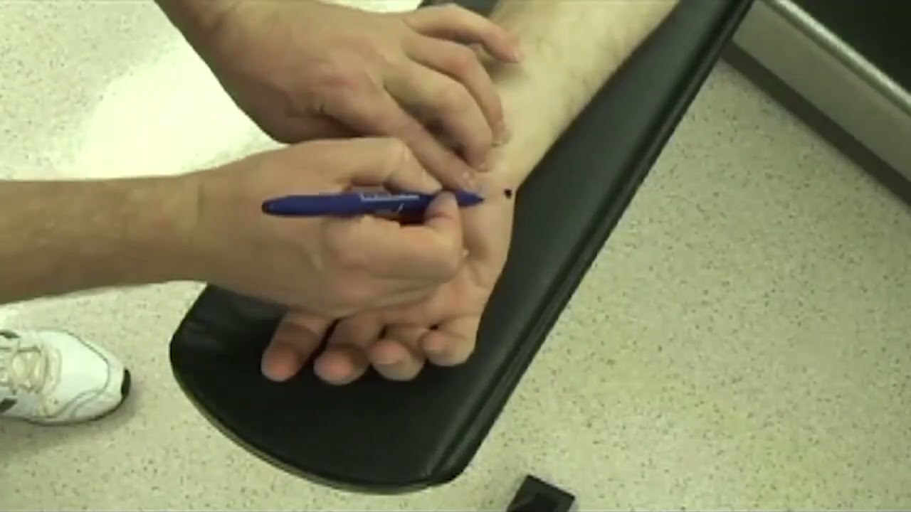 Video 26 11 Ulnar Nerve at Guyon Canal