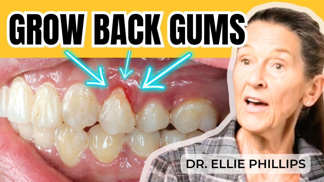 How to Avoid Gum Recession & Grow Back Gums