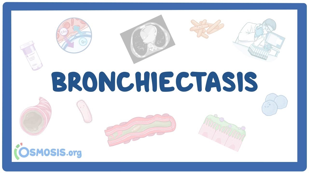 Bronchiectasis - physiology, pathology, clinical manifestations, diagnosis, treatment
