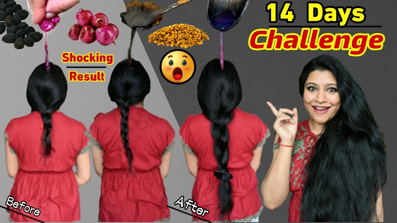 14 Days 10× Thick,Black & Long Hair Growth Challenge:No Hair Thinning No Premature Hair Greying