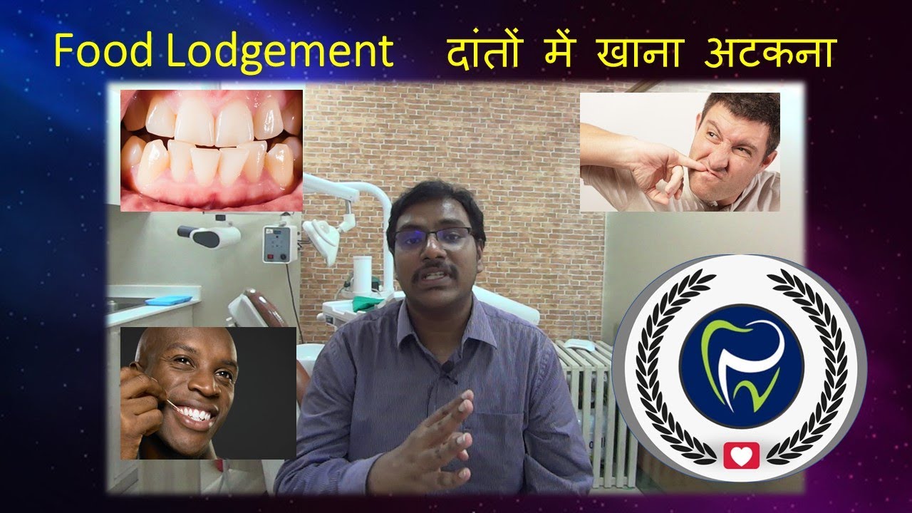 Dr Rudra Mohan | दांतों में खाना अटकना Dr Rudra's Dental Clinic| सबसे आम दंत समस्या|डॉ रुद्र मोहन